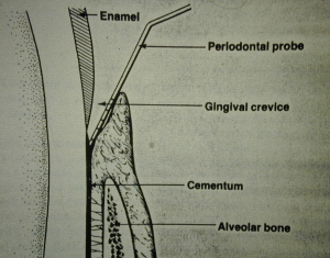 Diagram of ‘how to use a periodontal probe’